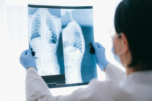 A doctor holding an x-ray result