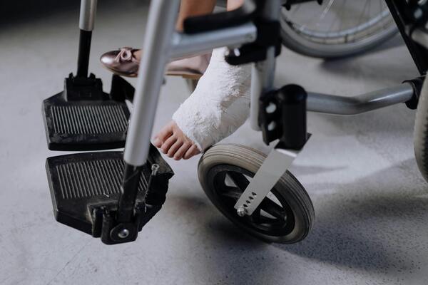 A person's leg in a cast and in a wheelchair