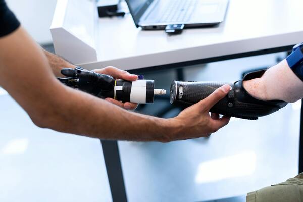 Person holding a prosthetic arm