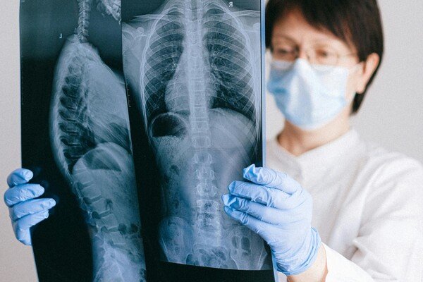 A doctor looking at an x-ray result
