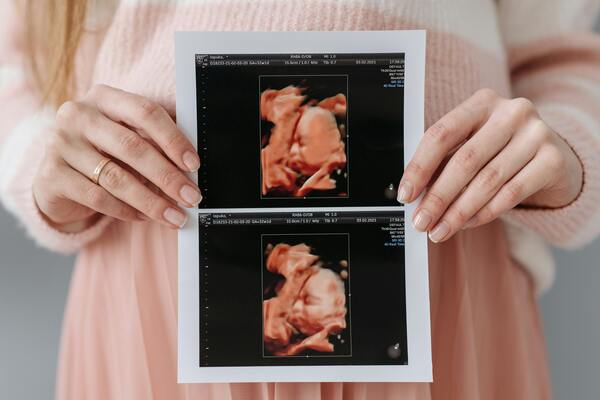 Woman holding printed ultrasound images of a developing baby, representing early pregnancy, IVF success, and prenatal care.